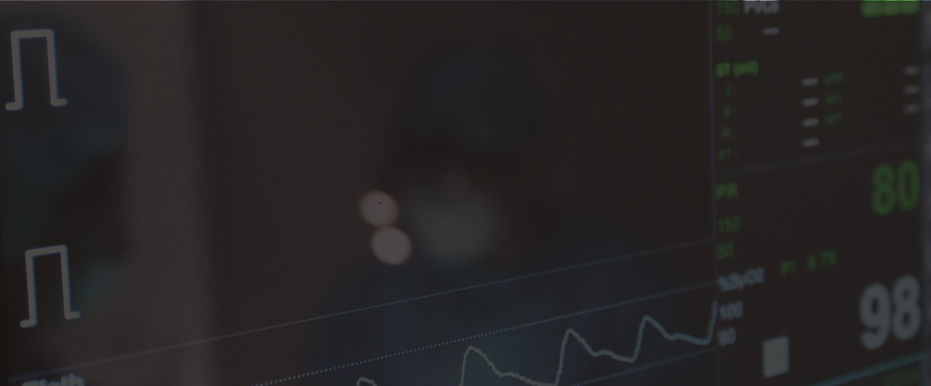 심전도계 모니터